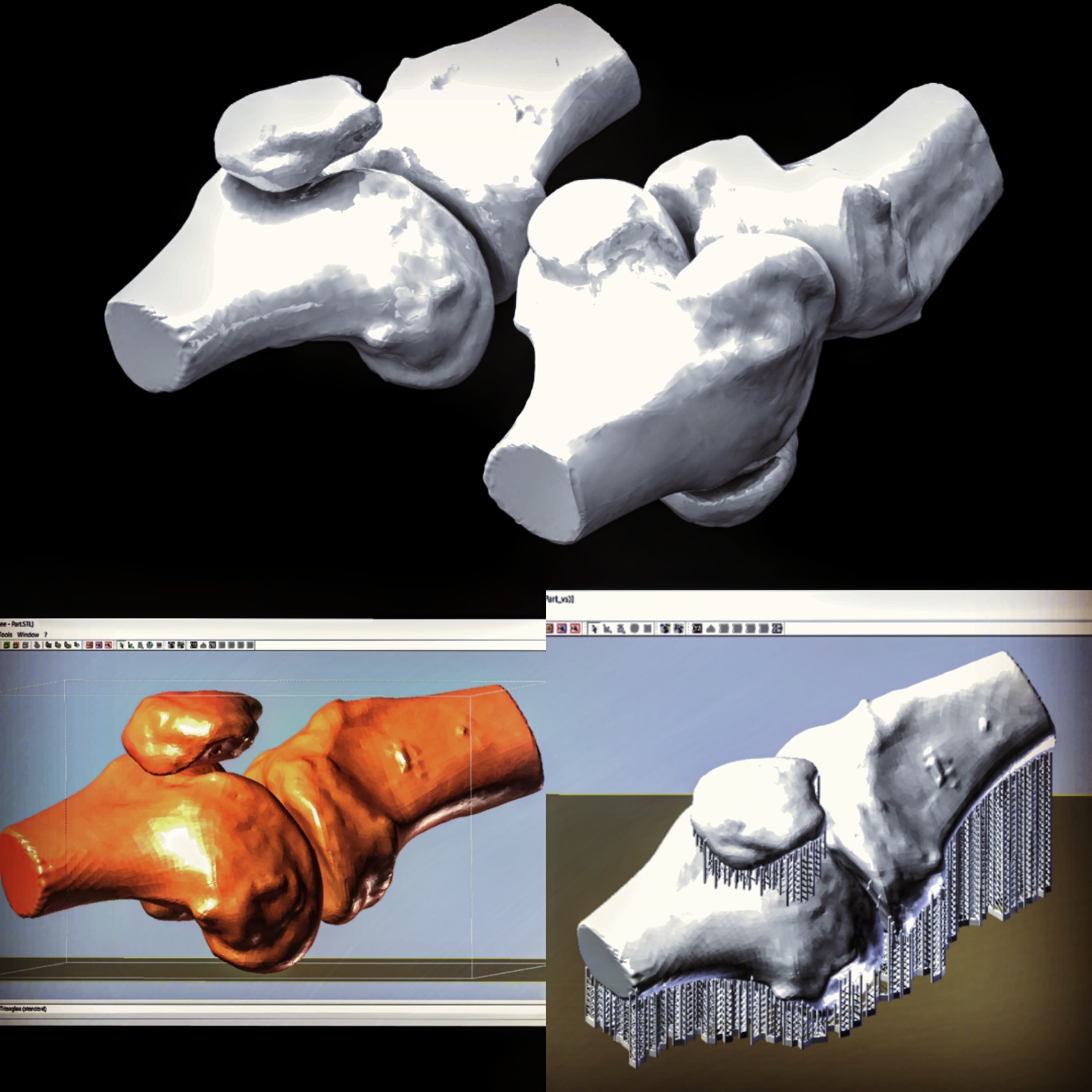 Knee Joint Model